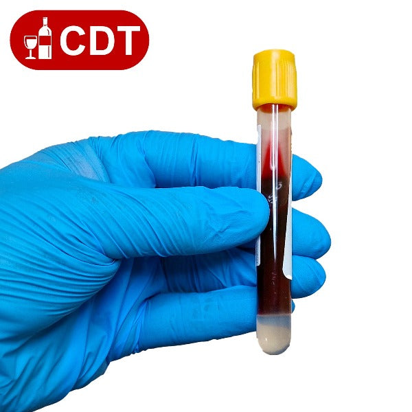 CDT Blood Test London | Alcohol Misuse