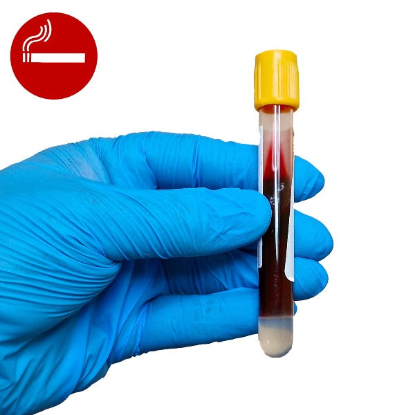Gloved hand holding a blood test tube