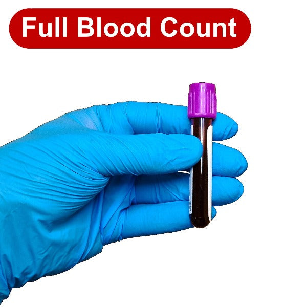 Gloved hand holding a blood test tube