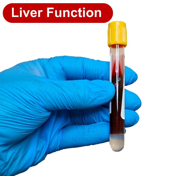 Gloved hand holding a blood test tube