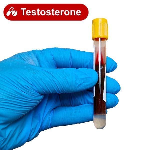 Gloved hand holding a blood test tube