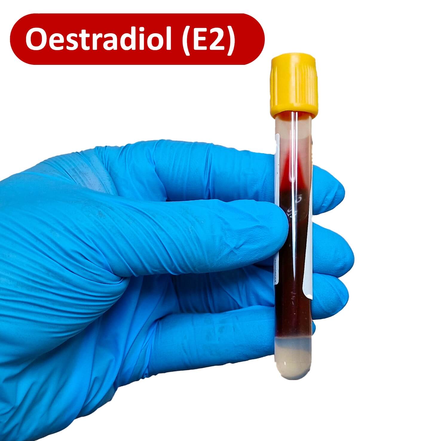 Oestradiol Test (E2) | Private Hormone Test UK
