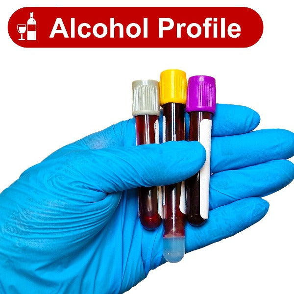 Gloved hand holding 3 blood test tubes