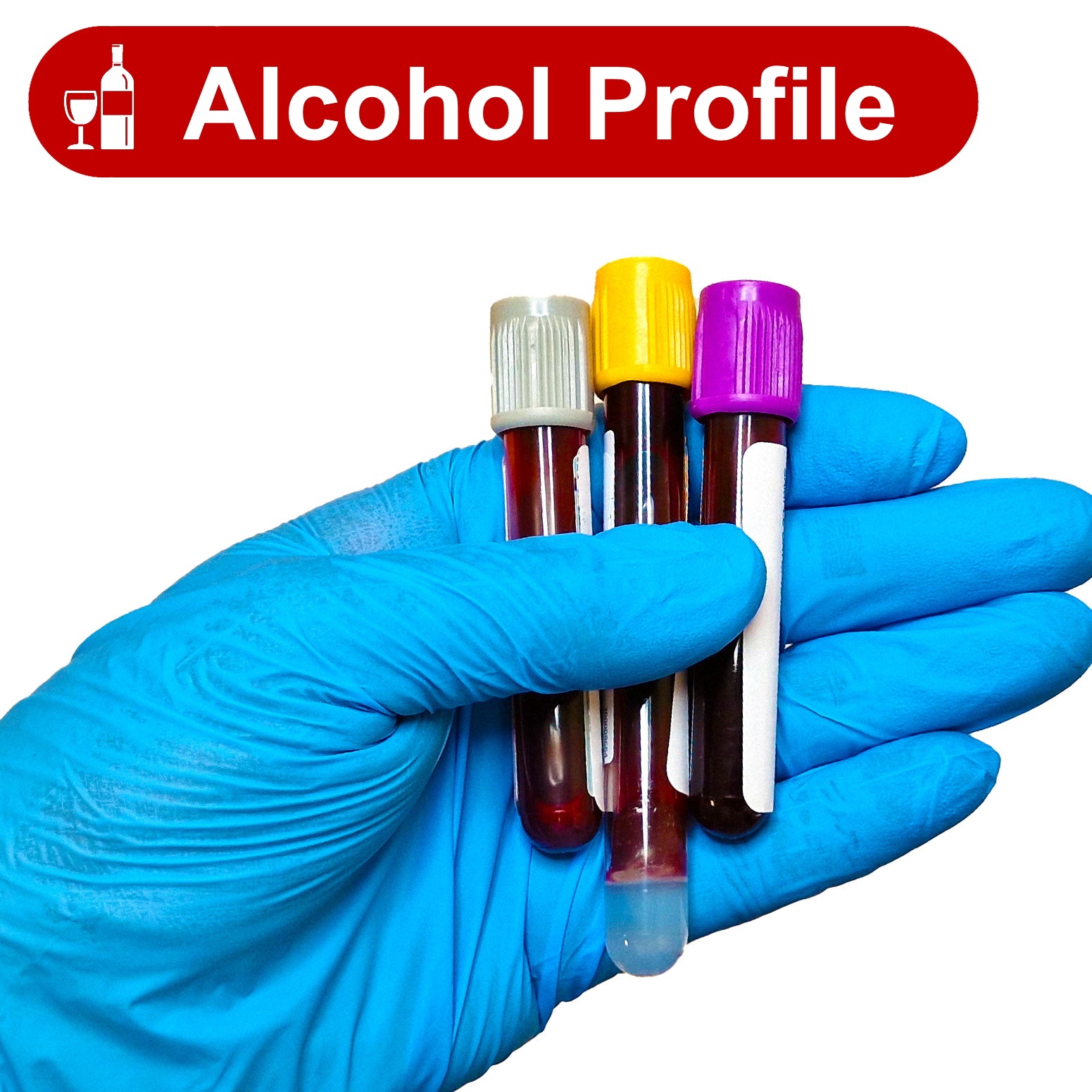 Alcohol profile test