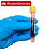 Amphetamine Test (Blood)