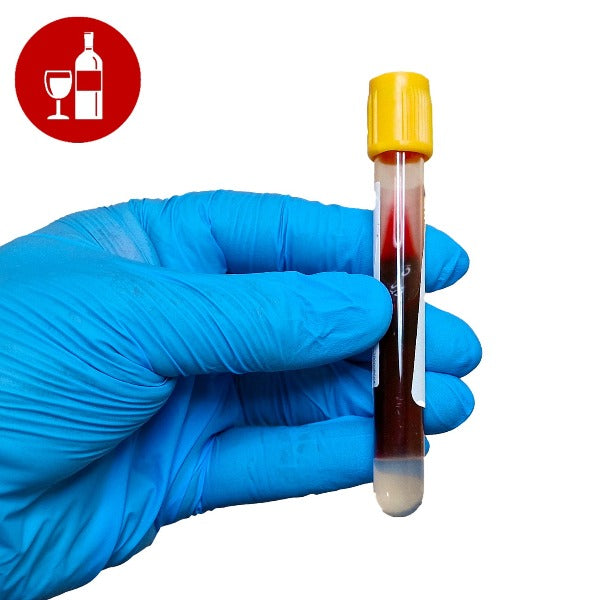 Gloved hand holding a blood test tube