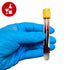 Alcohol Blood Test