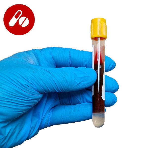 Gloved hand holding a blood test tube
