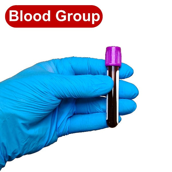 Gloved hand holding a blood test tube