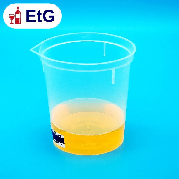 Urine EtG Test (Ethyl Glucuronide) Drug Test London