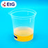 Urine container
